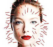 Беби Фейс Иглотерапия